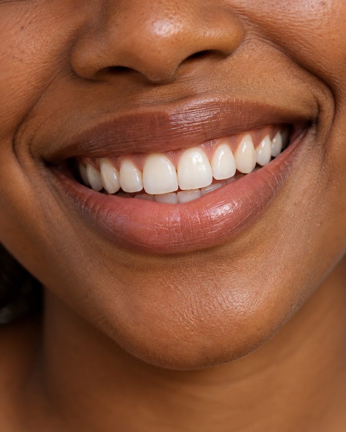 Gros plan sur un sourire naturel